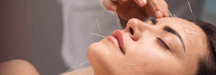 Chiropractic Carlsbad CA Head Pain Relief Acupuncture